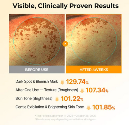 TX-Kojic Acid Turmeric Toner Pads